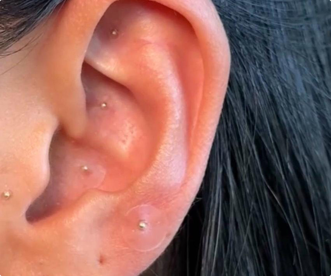 ear-seed-kit-stress-anxiety step 1