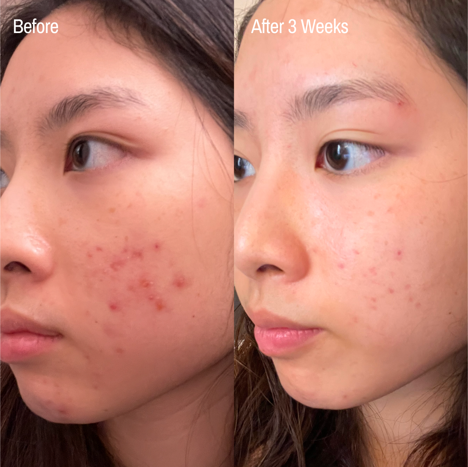 Complete Calm Trio + Free Gua Sha