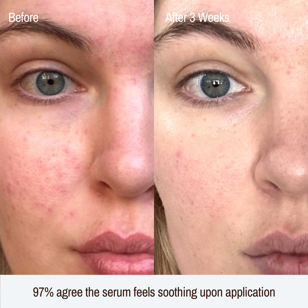 Renew Barrier Boosting Serum