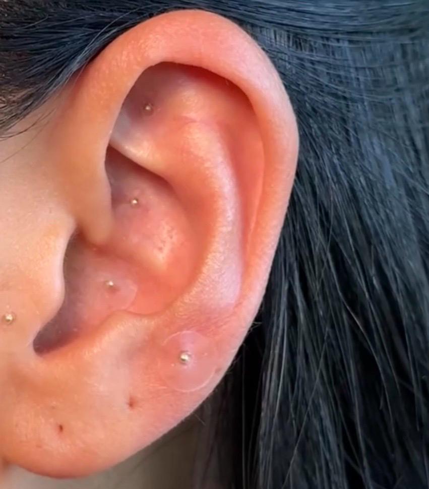 Ear Seed Kit: Stress & Anxiety